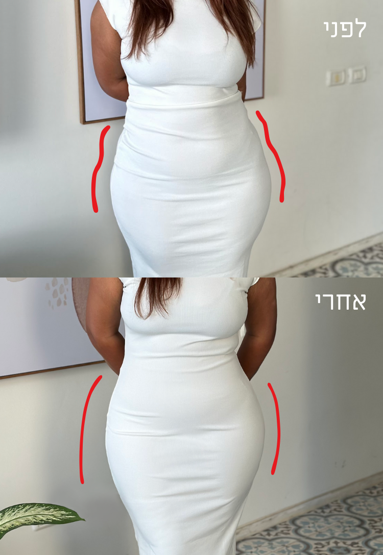 מחטב היילג ULTRASHPE